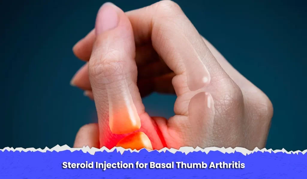 Steroid Injection for Basal Thumb Arthritis