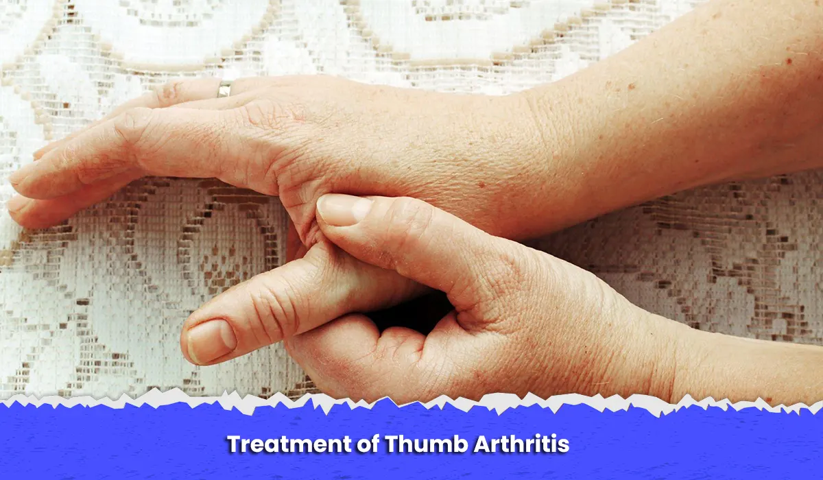 Treatment of Thumb Arthritis